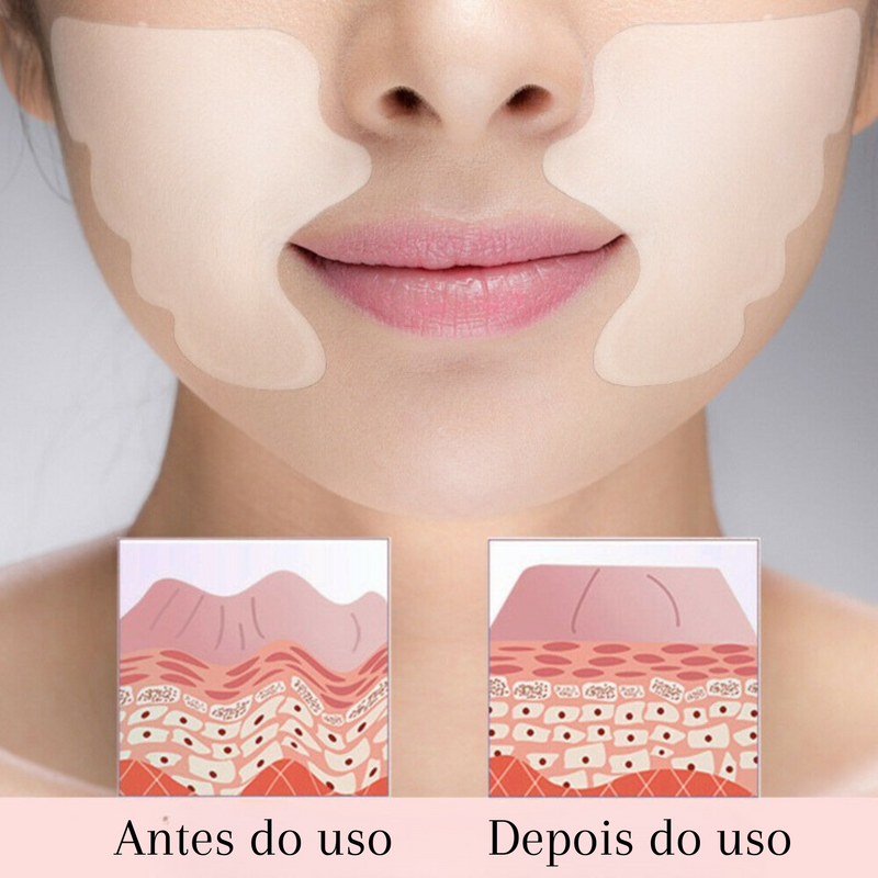 Adesivos Antirrugas FitBotox®